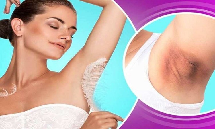 In the desire to wear sleeveless dress in summer, apply these 5 home remedies on dark underarms, which will make underarms fair