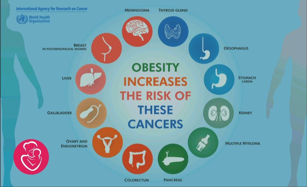 Obesity causes 13 types of cancer 