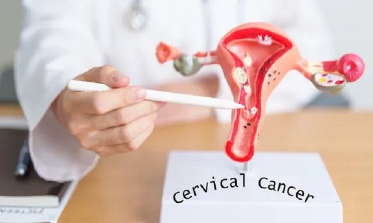HPV Vaccine: महिलाओं में सर्वाइकल कैंसर आम बात (Cervical cancer is common in women)