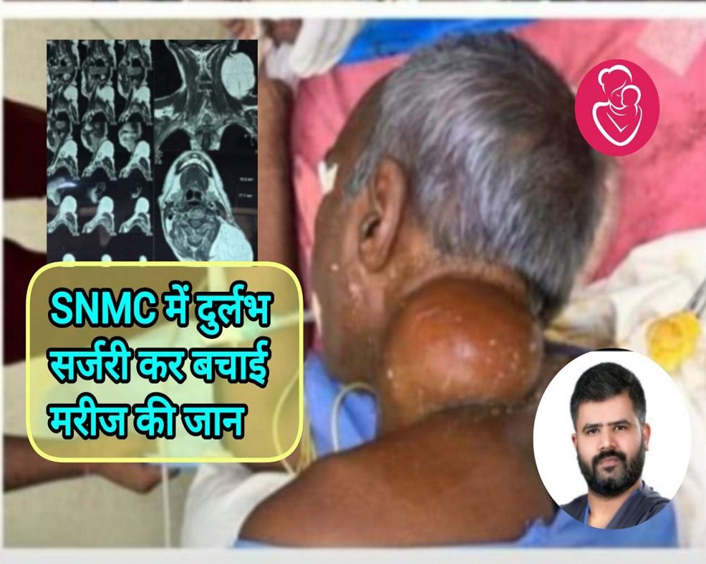 SNMC Agra: जापान के बाद UP में डॉक्टर्स ने की दुर्लभ सर्जरी