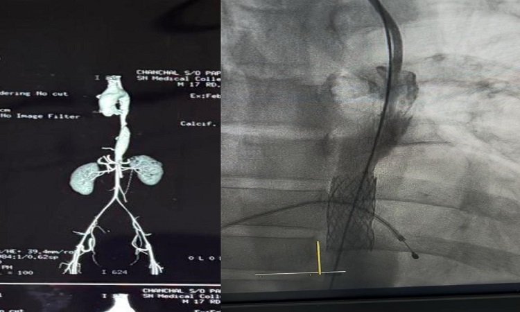 SNMC Agra: जटिल डायग्नोसिस और सफल प्रक्रिया